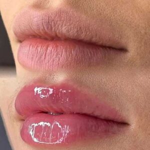 Hidra lips em Pedreiras-MA Trizidela do vale-ma